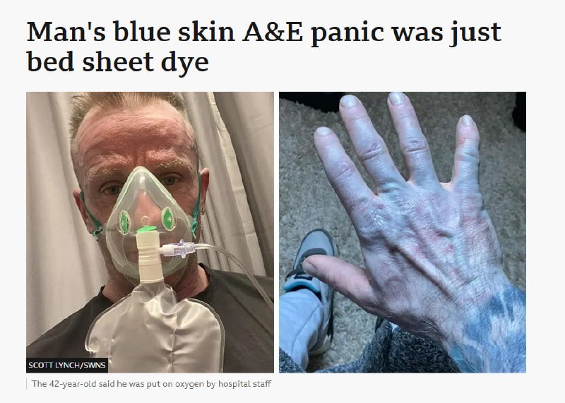 段子成真😅英国男子Tommy Lynch一觉醒来发现自己变成了阿凡达，皮肤变蓝，紧急送医后发现是他的床单掉色了……Tommy Lynch说