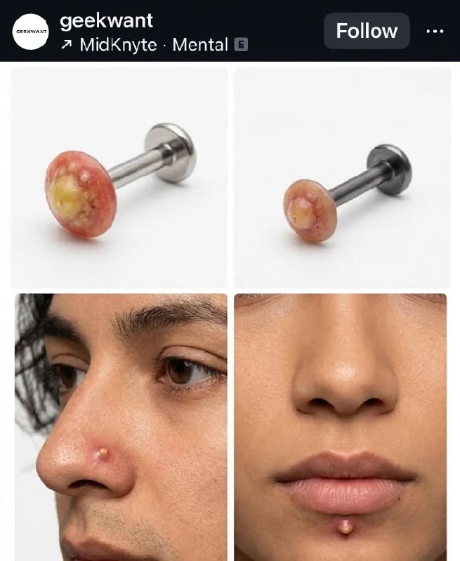 我理解不了这种时尚（鼻/唇钉）😅