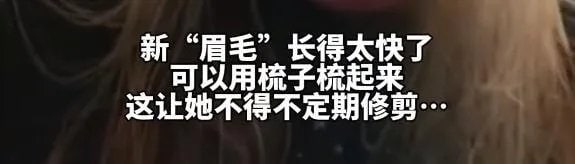 国外一女子将头发毛囊移植到眉毛上🤔国外一女子将头发毛囊移植到眉毛上🤔