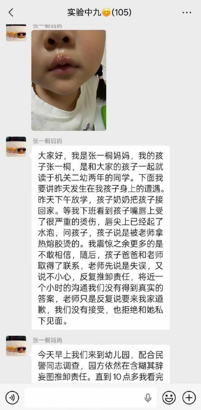 女童被幼儿园老师用热熔胶烫嘴虐待近日，有江苏徐州丰县的幼儿家长通过社交平台反映称，孩子在丰县机关第二幼儿园上学时，遭到老师用热熔胶故意烫伤嘴唇，并遭到虐待体罚，此事引发关注