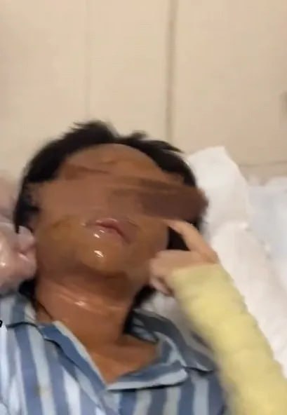 湖南一女主播收到炸弹包裹被炸伤10月16日，湖南一女主播收到炸弹包裹被炸伤引发热议